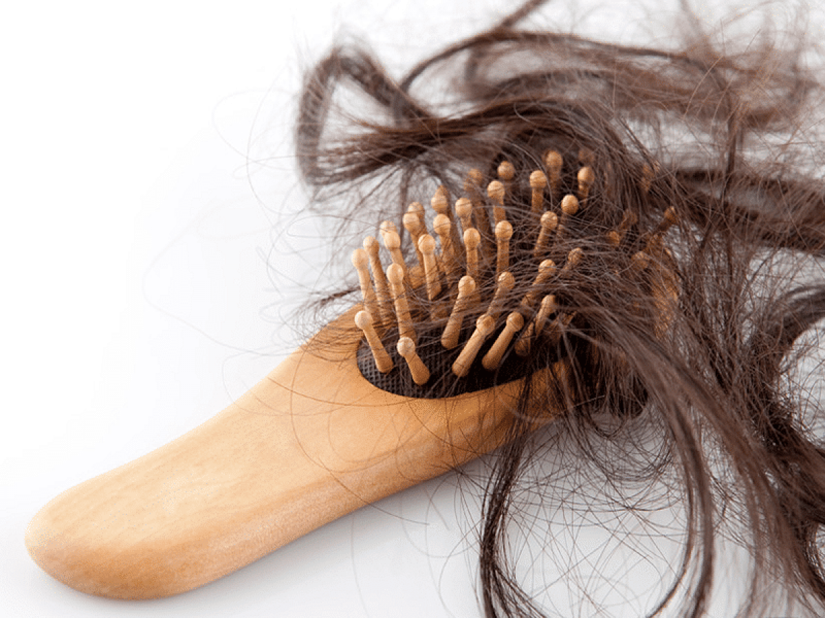 Hacer la vida Cuerda Transporte Pérdida de cabello: Los mejores principios activos para combatirla